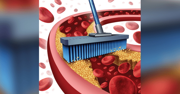 7 Simple Home Remes That Will Help Clean Your Arteries 7 Simple Home Remes That Will Help Clean Your Arteries