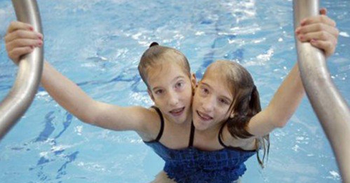 abby and brittany hensel x ray abby and brittany hensel x ray