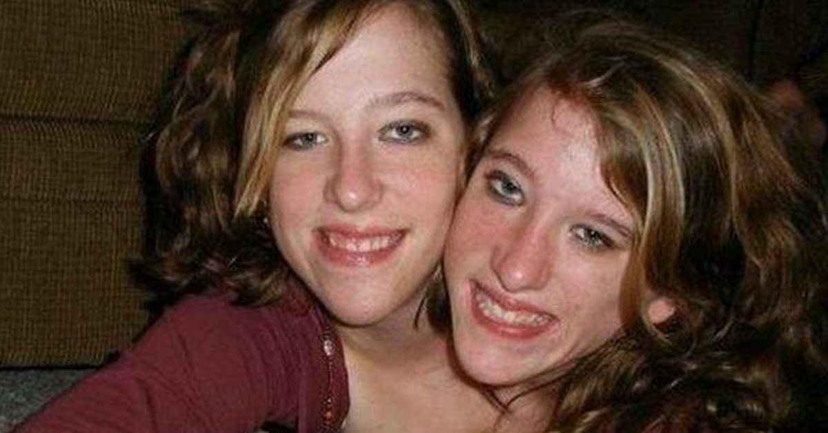 abby and brittany hensel x ray abby and brittany hensel x ray