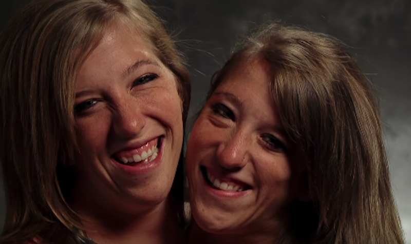 abby and brittany hensel. abby and brittany hensel.