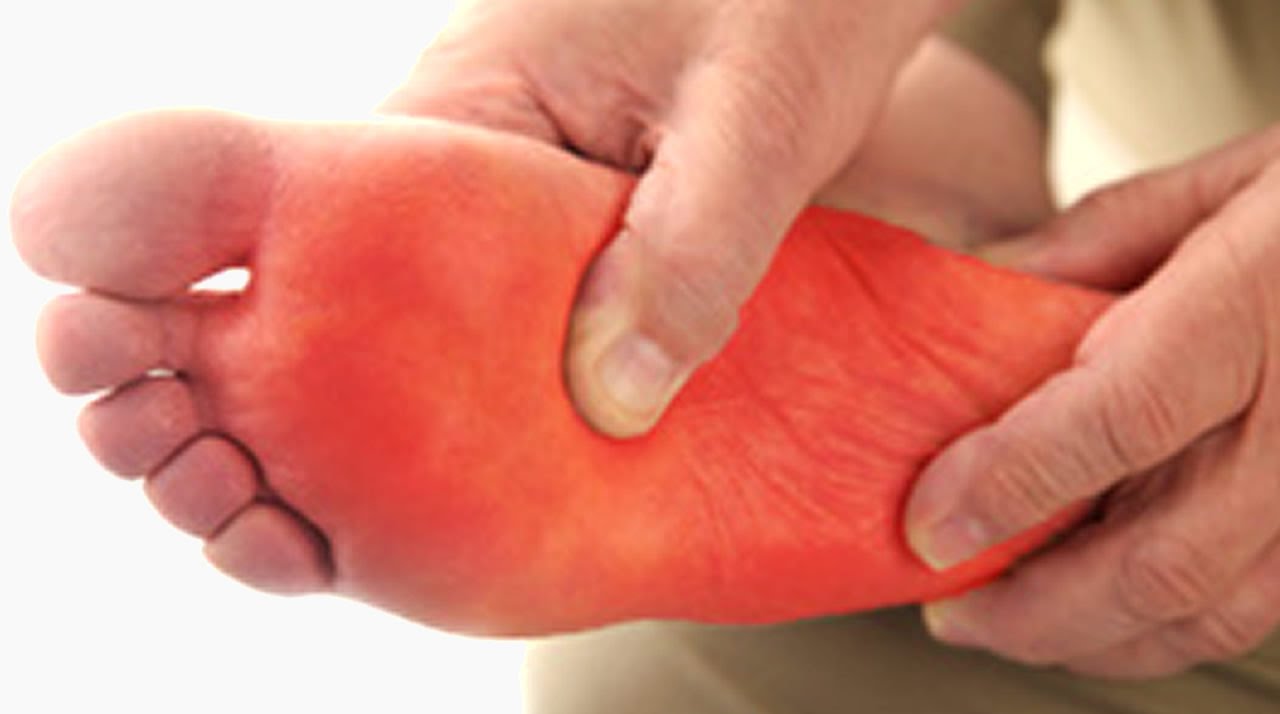 Paresthesia to the foot image