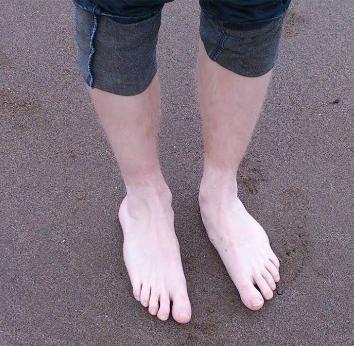 really wide feet